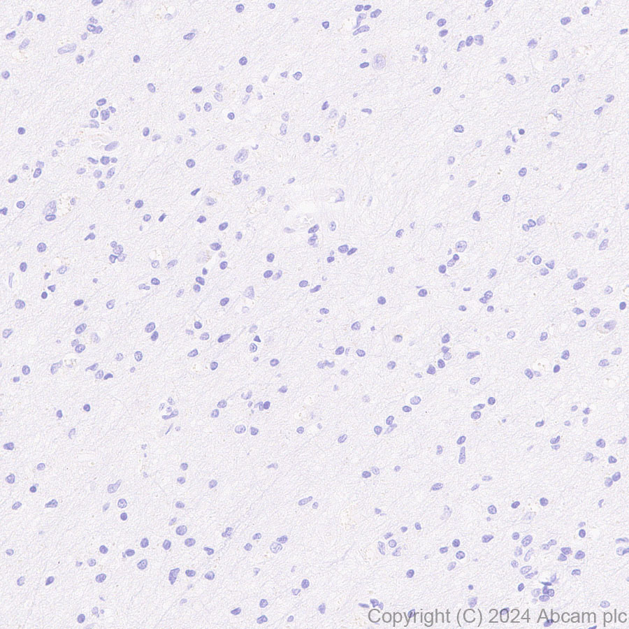 Immunohistochemistry (Formalin/PFA-fixed paraffin-embedded sections) - Anti-Fc epsilon RI/FCER1A antibody [EPR28402-78] (ab316199), expandable thumbnail
