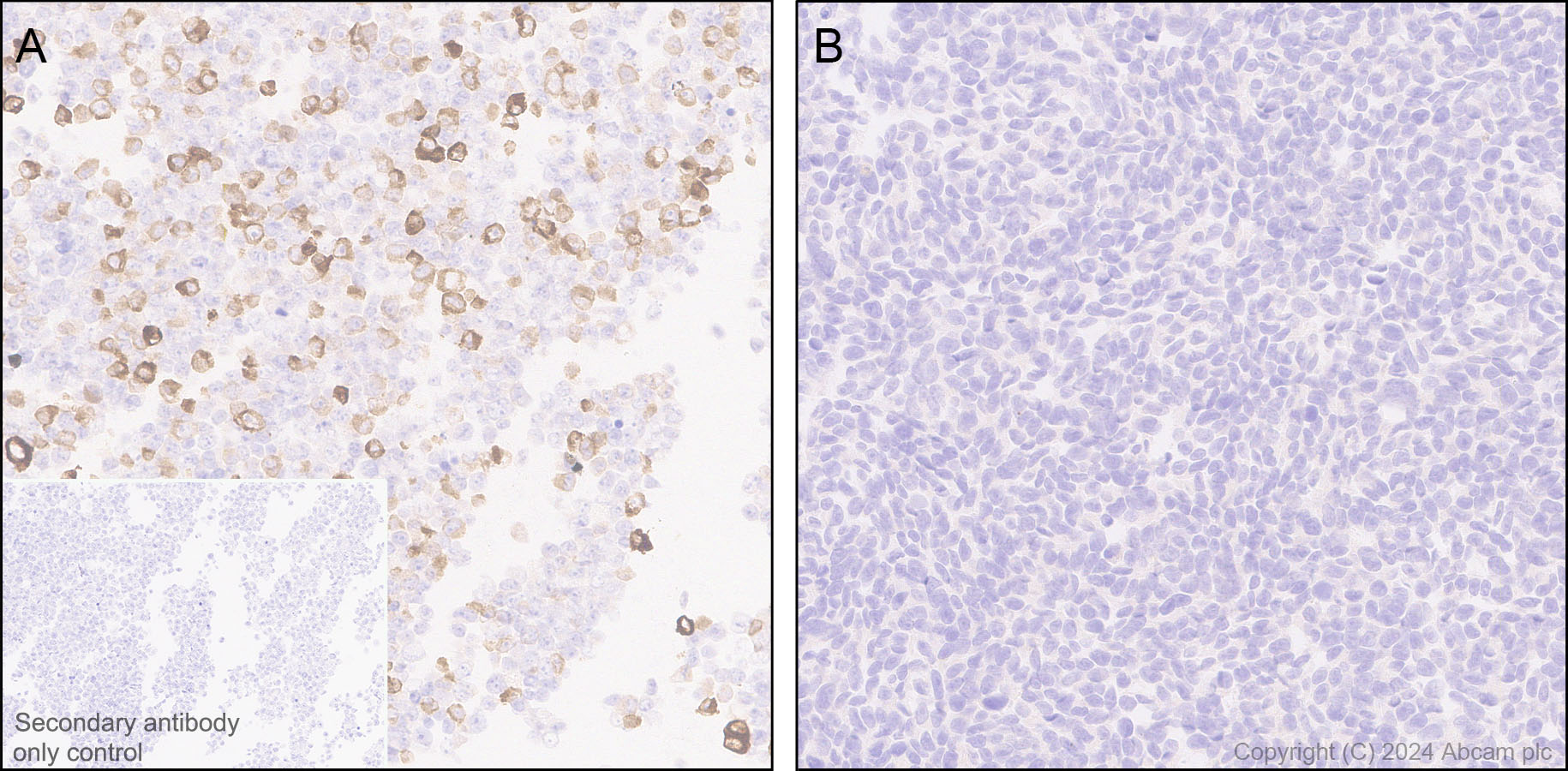 Immunohistochemistry (Formalin/PFA-fixed paraffin-embedded sections) - Anti-Fc epsilon RI/FCER1A antibody [EPR28402-78] (ab316199), expandable thumbnail