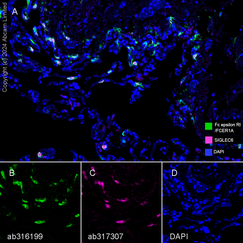 Multiplex immunohistochemistry - Anti-Fc epsilon RI/FCER1A antibody [EPR28402-78] (AB316199), expandable thumbnail