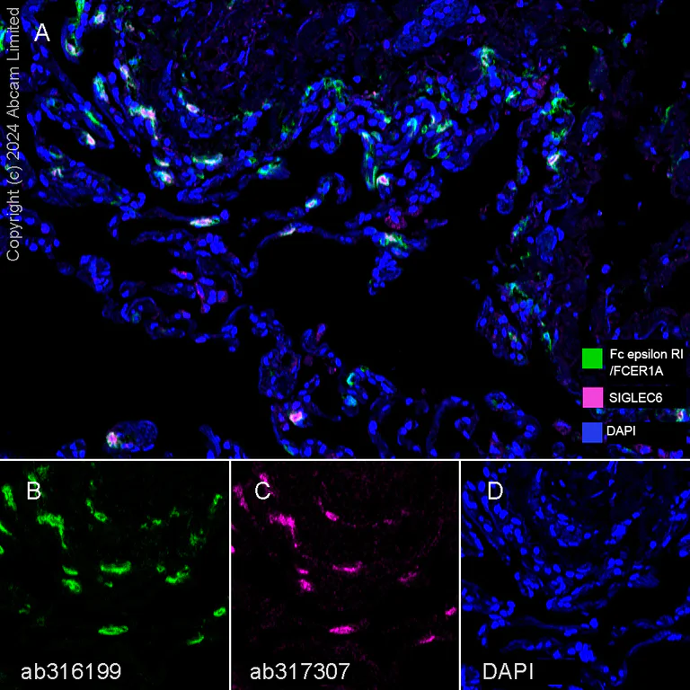 Multiplex immunohistochemistry - Anti-Fc epsilon RI/FCER1A antibody [EPR28402-78] (AB316199)