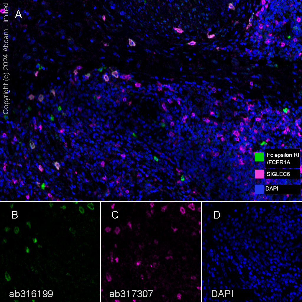 Multiplex immunohistochemistry - Anti-Fc epsilon RI/FCER1A antibody [EPR28402-78] (AB316199), expandable thumbnail