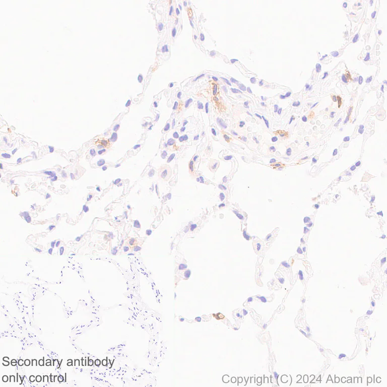 Immunohistochemistry (Formalin/PFA-fixed paraffin-embedded sections) - Anti-Fc epsilon RI/FCER1A antibody [EPR28402-78] - BSA and Azide free (AB316200)