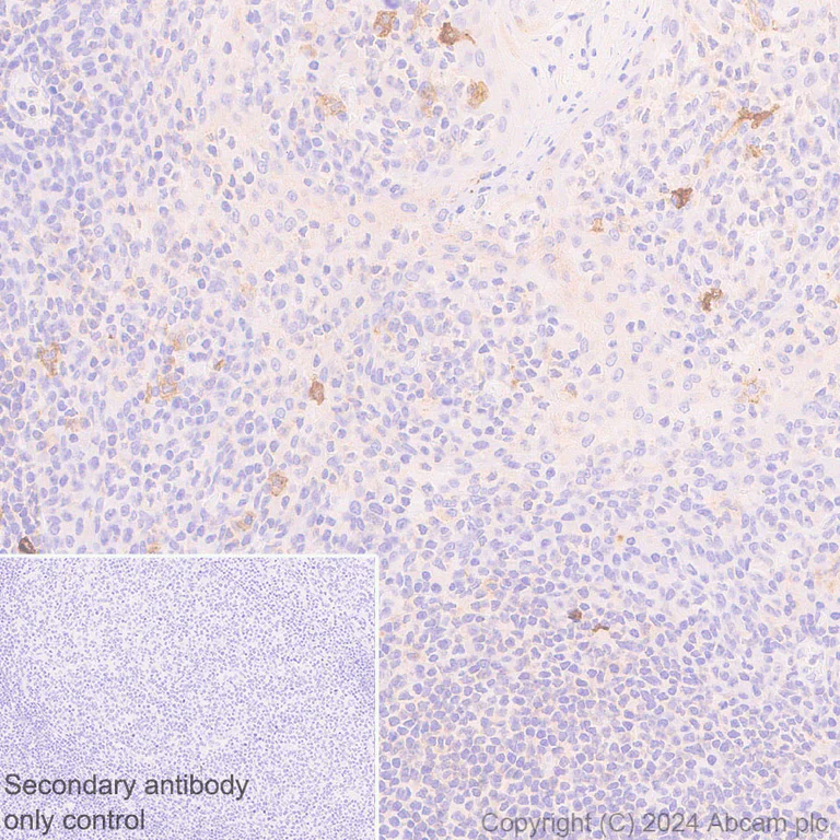 Immunohistochemistry (Formalin/PFA-fixed paraffin-embedded sections) - Anti-Fc epsilon RI/FCER1A antibody [EPR28402-78] - BSA and Azide free (AB316200)