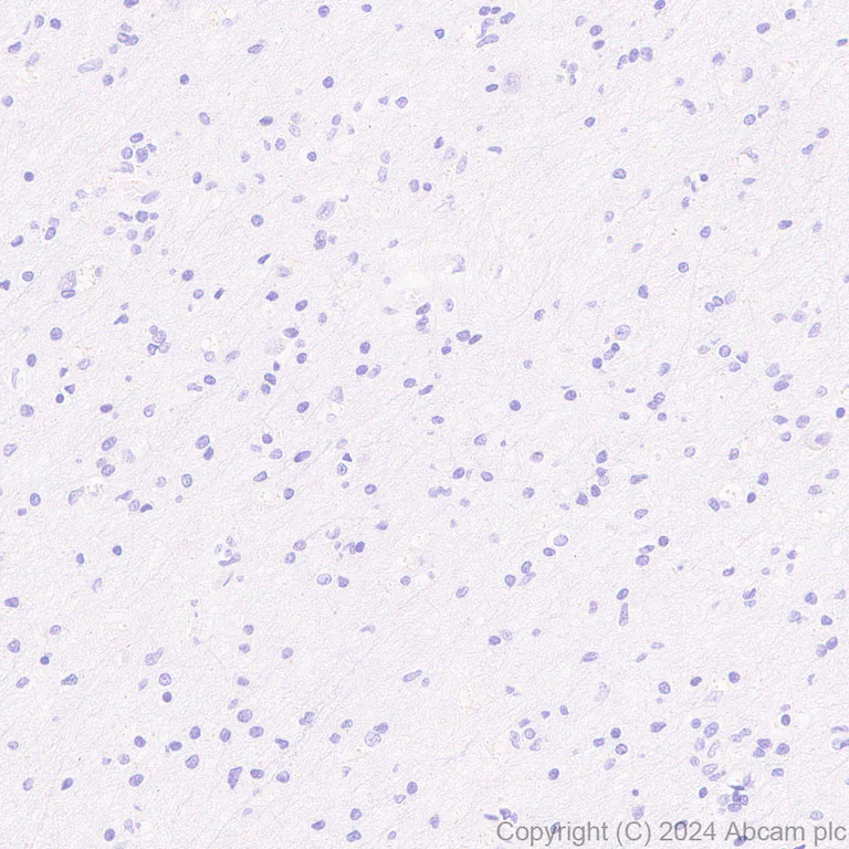 Immunohistochemistry (Formalin/PFA-fixed paraffin-embedded sections) - Anti-Fc epsilon RI/FCER1A antibody [EPR28402-78] - BSA and Azide free (AB316200)