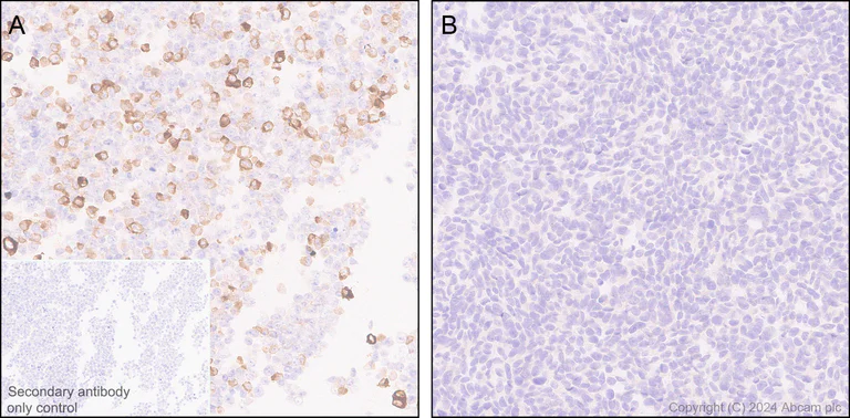 Immunohistochemistry (Formalin/PFA-fixed paraffin-embedded sections) - Anti-Fc epsilon RI/FCER1A antibody [EPR28402-78] - BSA and Azide free (AB316200)