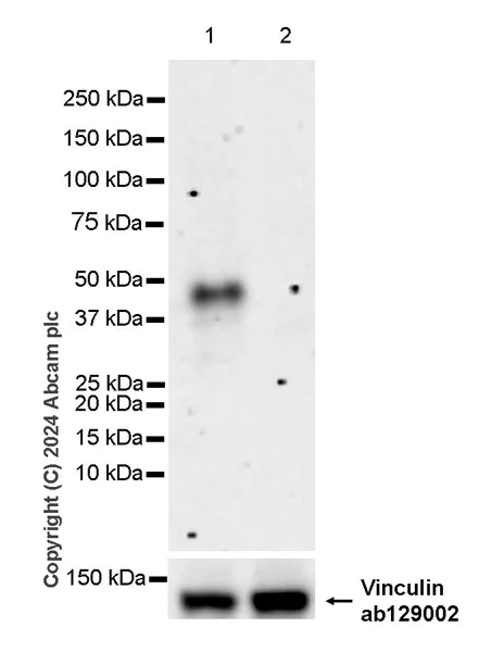 Western blot - Anti-Fc epsilon RI/FCER1A antibody [EPR28402-78] - BSA and Azide free (AB316200)