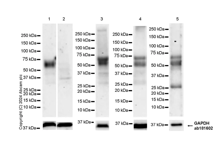 Western blot - Anti-Fc epsilon RI/FCER1A antibody [EPR28402-78] - BSA and Azide free (AB316200)