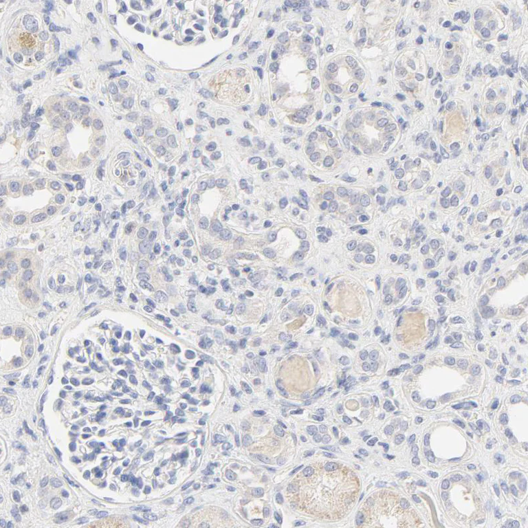 Immunohistochemistry (Formalin/PFA-fixed paraffin-embedded sections) - Anti-FCGBP antibody (AB121199)