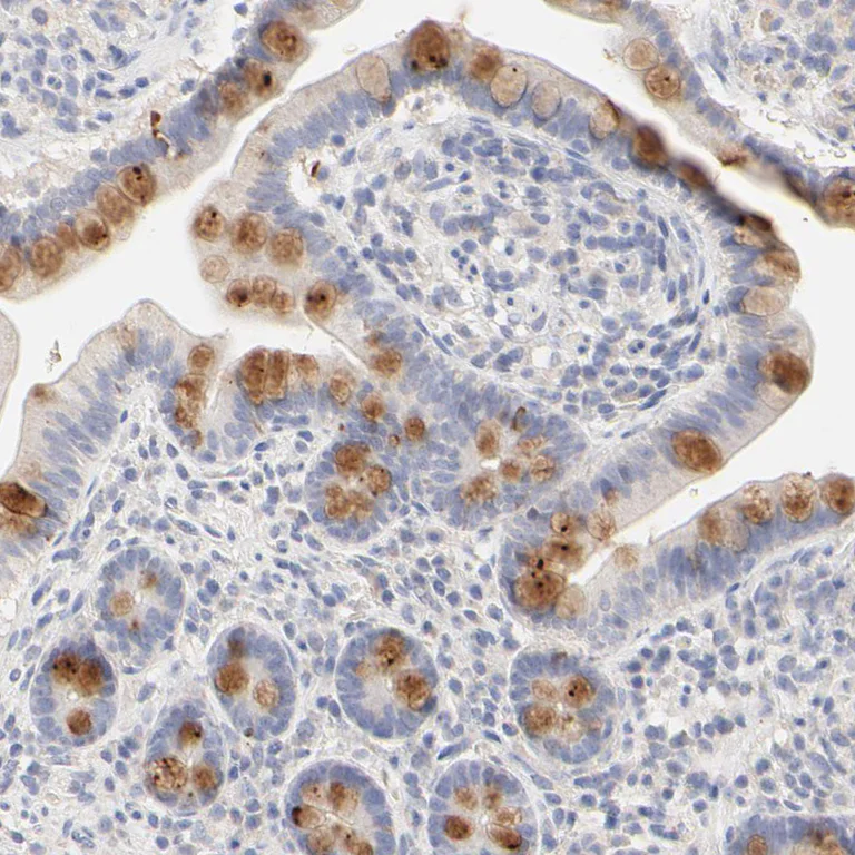 Immunohistochemistry (Formalin/PFA-fixed paraffin-embedded sections) - Anti-FCGBP antibody (AB121199)