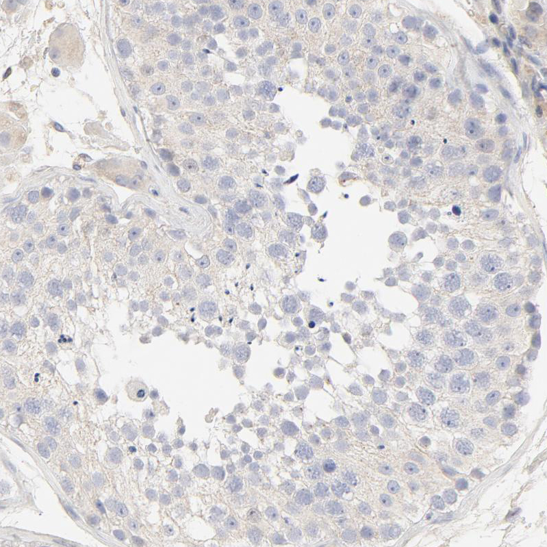 Immunohistochemistry (Formalin/PFA-fixed paraffin-embedded sections) - Anti-FCGBP antibody (AB121199)