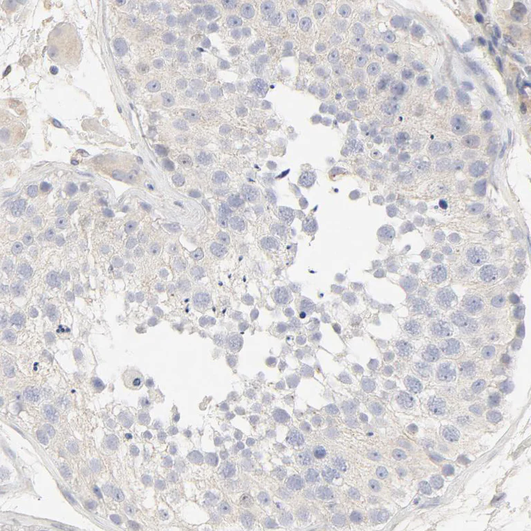 Immunohistochemistry (Formalin/PFA-fixed paraffin-embedded sections) - Anti-FCGBP antibody (AB121199)