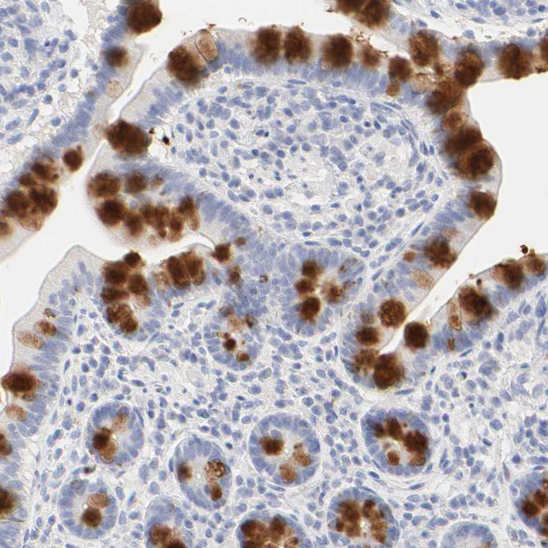 Immunohistochemistry (Formalin/PFA-fixed paraffin-embedded sections) - Anti-FCGBP antibody (AB121202)