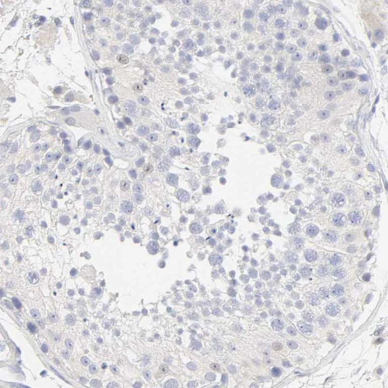 Immunohistochemistry (Formalin/PFA-fixed paraffin-embedded sections) - Anti-FCGBP antibody (AB121202)