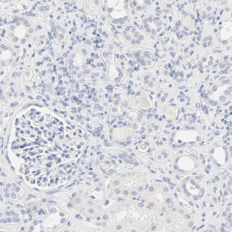 Immunohistochemistry (Formalin/PFA-fixed paraffin-embedded sections) - Anti-FCGBP antibody (AB121202)