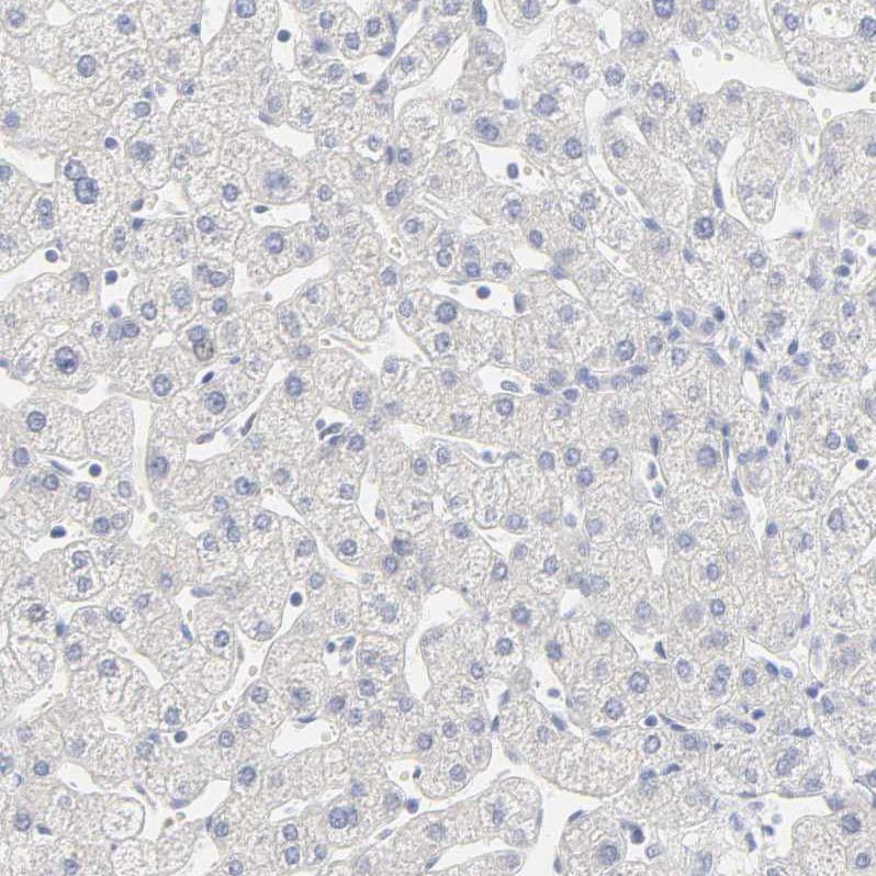 Immunohistochemistry (Formalin/PFA-fixed paraffin-embedded sections) - Anti-FCGBP antibody (AB121202)