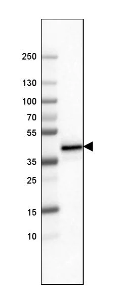 Western blot - Anti-FCGRT/FCRN antibody [CL3640] (AB223381)