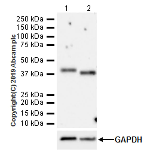 Western blot - Anti-FCGRT/FCRN antibody [EPR22627-25] (AB228975)
