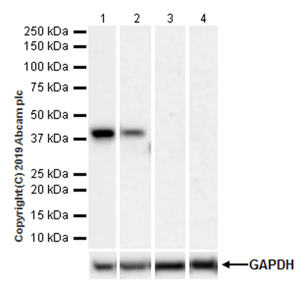 Western blot - Anti-FCGRT/FCRN antibody [EPR22627-25] (AB228975)