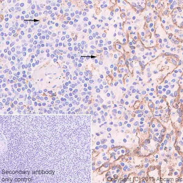 Immunohistochemistry (Formalin/PFA-fixed paraffin-embedded sections) - Anti-FCGRT/FCRN antibody [EPR22627-25] - BSA and Azide free (AB256121)