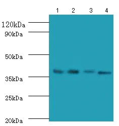 Western blot - Anti-FCGRT/FCRN antibody - Extracellular domain (AB193148)