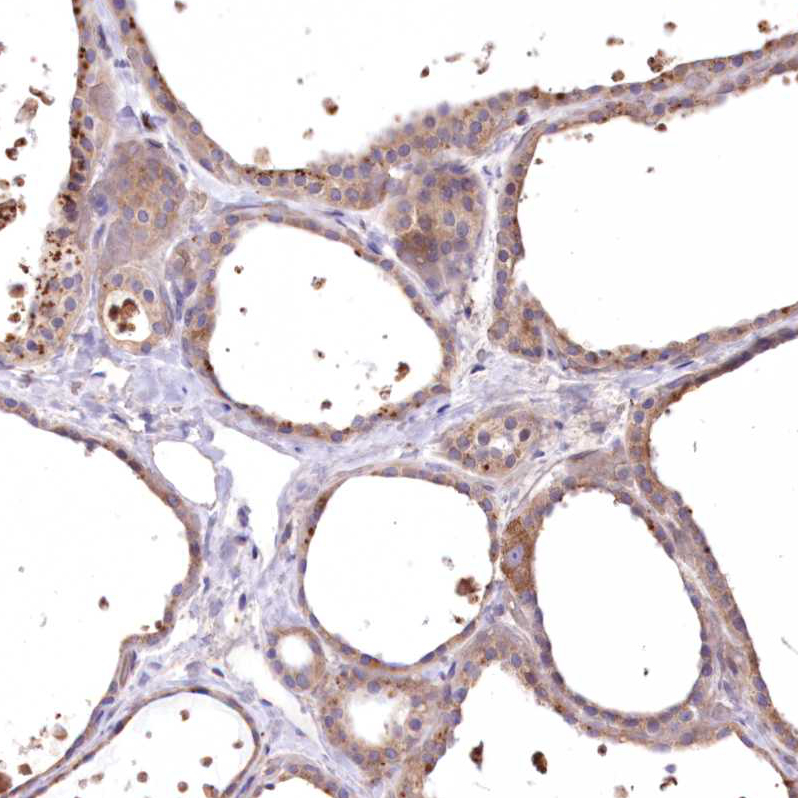 Immunohistochemistry (Formalin/PFA-fixed paraffin-embedded sections) - Anti-FCHO2 antibody (AB122407), expandable thumbnail