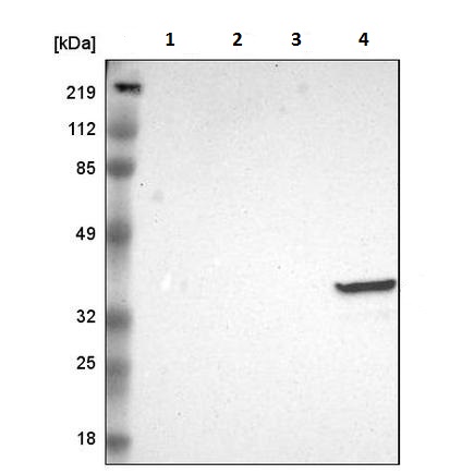 Western blot - Anti-FCN1/M-Ficolin antibody (AB223712)