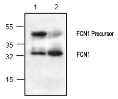 Western blot - Anti-FCN1/M-Ficolin antibody (AB70814)
