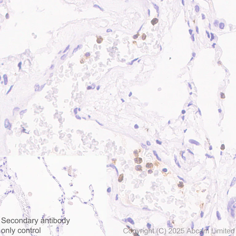 Immunohistochemistry (Formalin/PFA-fixed paraffin-embedded sections) - Anti-FCN1/M-Ficolin antibody [EPR29508-69] (AB325599)
