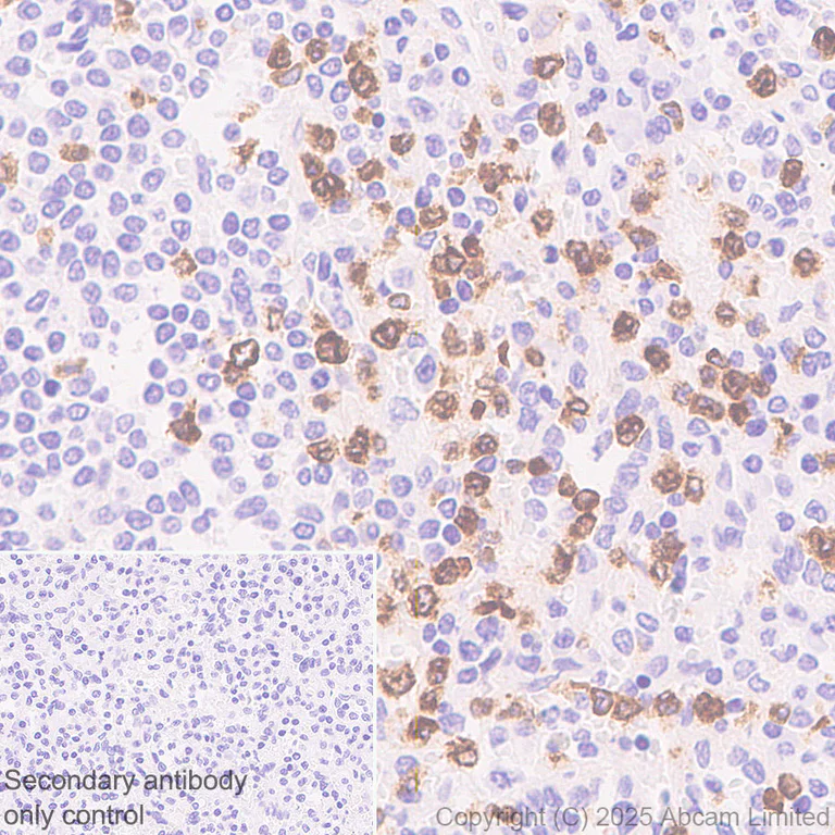 Immunohistochemistry (Formalin/PFA-fixed paraffin-embedded sections) - Anti-FCN1/M-Ficolin antibody [EPR29508-69] (AB325599)