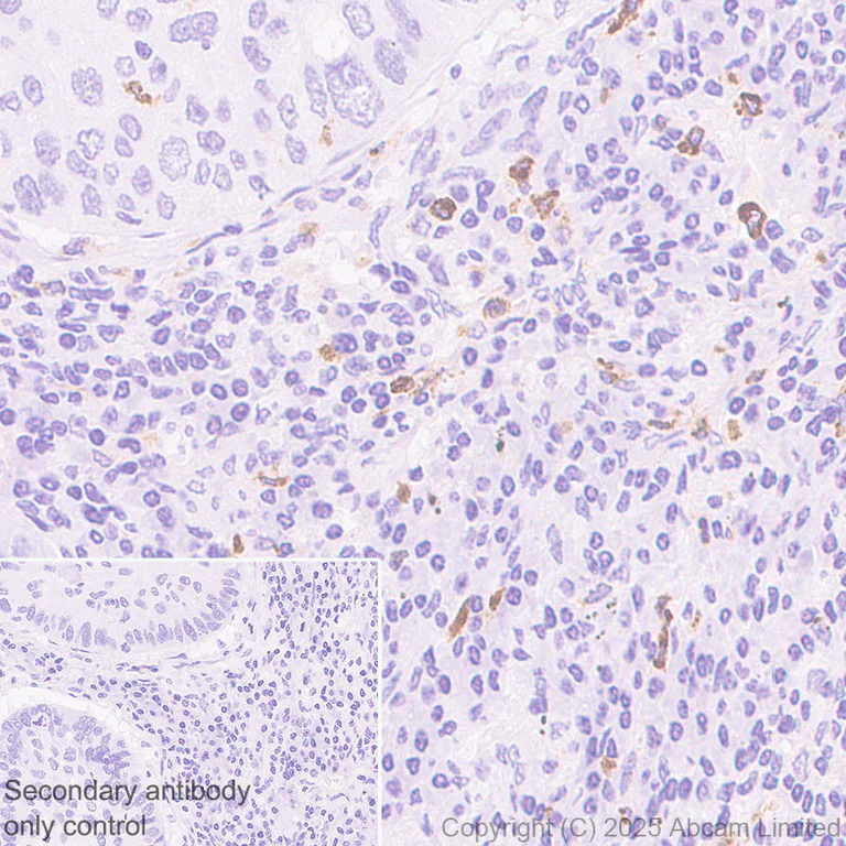 Immunohistochemistry (Formalin/PFA-fixed paraffin-embedded sections) - Anti-FCN1/M-Ficolin antibody [EPR29508-69] (AB325599)