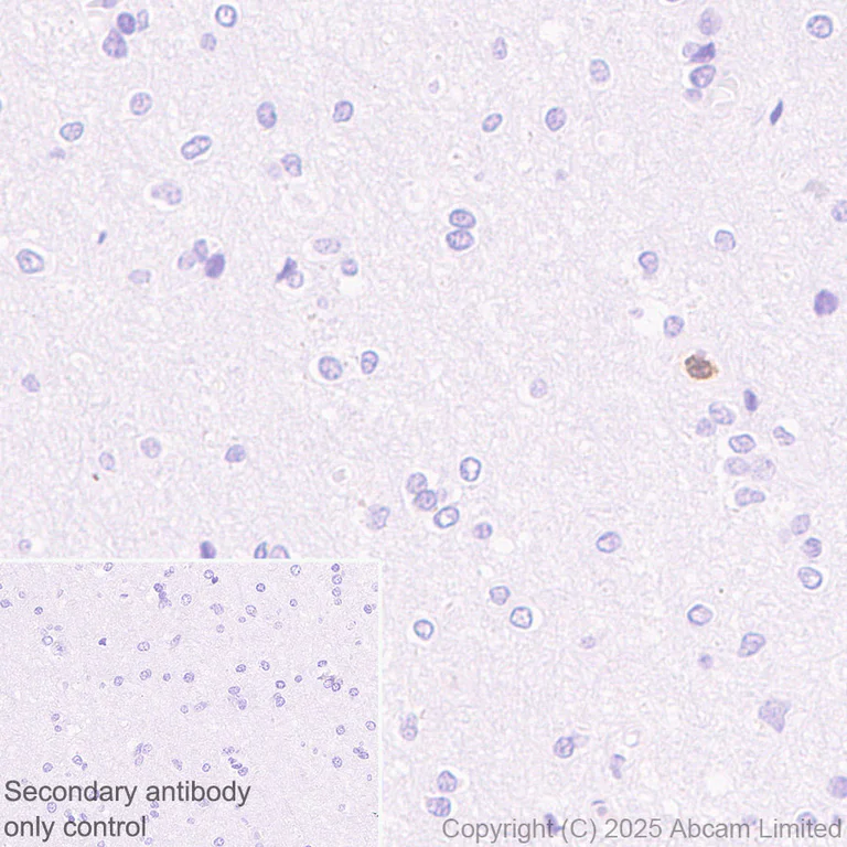 Immunohistochemistry (Formalin/PFA-fixed paraffin-embedded sections) - Anti-FCN1/M-Ficolin antibody [EPR29508-69] (AB325599)