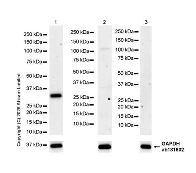 Western blot - Anti-FCN1/M-Ficolin antibody [EPR29508-69] (AB325599)