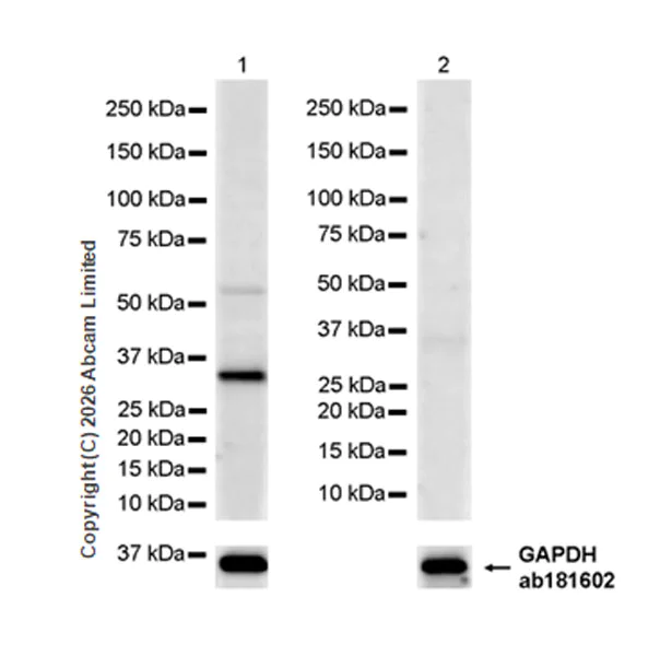 Western blot - Anti-FCN1/M-Ficolin antibody [EPR29508-69] (AB325599)