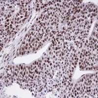 Immunohistochemistry (Formalin/PFA-fixed paraffin-embedded sections) - Anti-FCP1 antibody (AB137683)