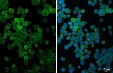Immunocytochemistry/ Immunofluorescence - Anti-FcRgamma antibody (AB151986)