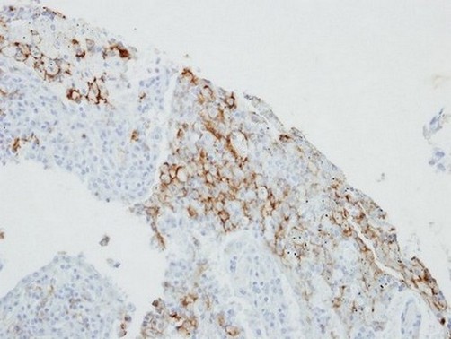 Immunohistochemistry (Formalin/PFA-fixed paraffin-embedded sections) - Anti-FcRgamma antibody (AB151986), expandable thumbnail