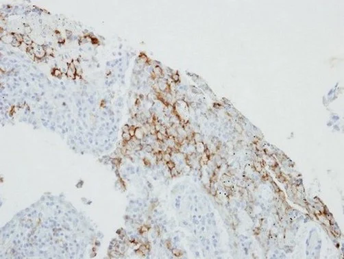 Immunohistochemistry (Formalin/PFA-fixed paraffin-embedded sections) - Anti-FcRgamma antibody (AB151986)