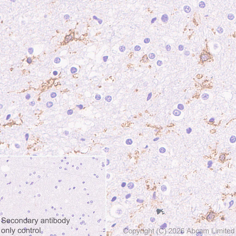 Immunohistochemistry (Formalin/PFA-fixed paraffin-embedded sections) - Anti-FcRgamma antibody [EPR30963-69] (AB325712)
