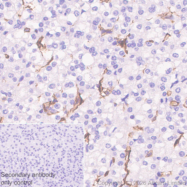 Immunohistochemistry (Formalin/PFA-fixed paraffin-embedded sections) - Anti-FcRgamma antibody [EPR30963-69] (AB325712)