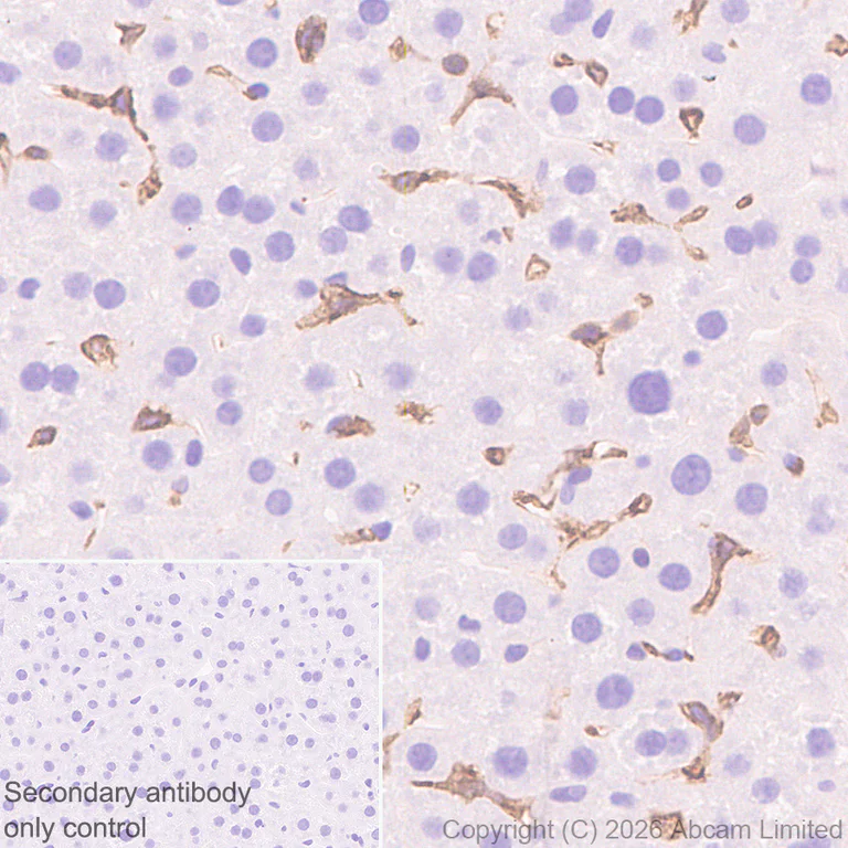 Immunohistochemistry (Formalin/PFA-fixed paraffin-embedded sections) - Anti-FcRgamma antibody [EPR30963-69] (AB325712)