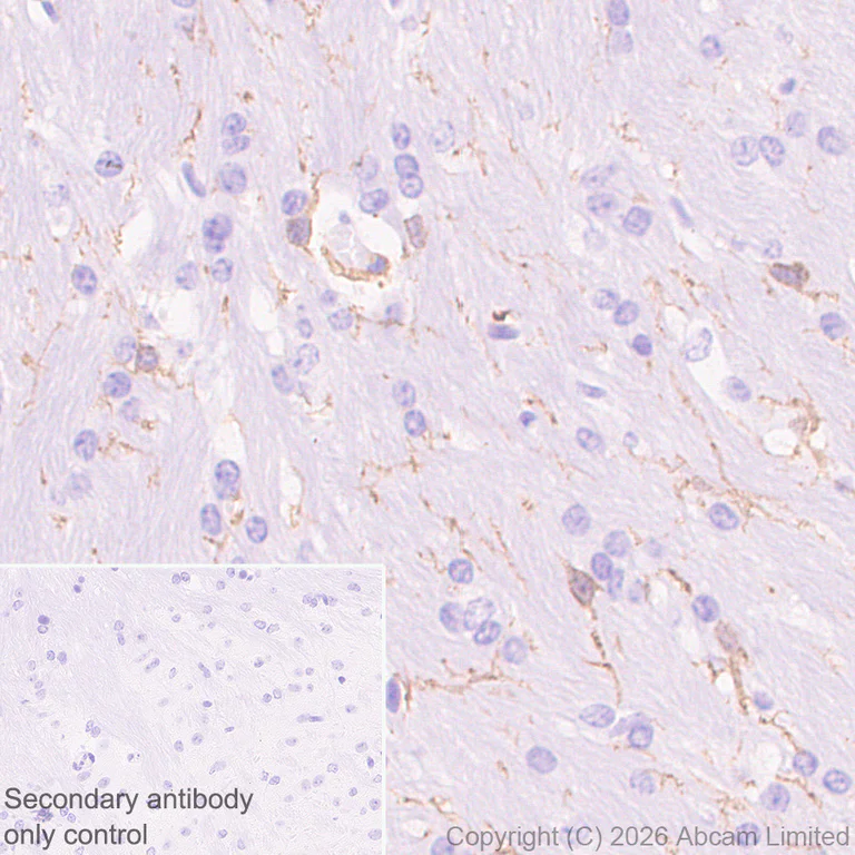 Immunohistochemistry (Formalin/PFA-fixed paraffin-embedded sections) - Anti-FcRgamma antibody [EPR30963-69] (AB325712)
