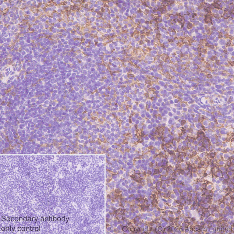 Immunohistochemistry (Formalin/PFA-fixed paraffin-embedded sections) - Anti-FcRgamma antibody [EPR30963-69] (AB325712)