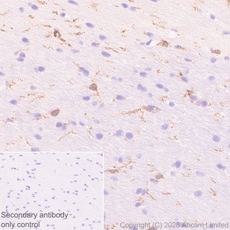 Immunohistochemistry (Formalin/PFA-fixed paraffin-embedded sections) - Anti-FcRgamma antibody [EPR30963-69] (AB325712)