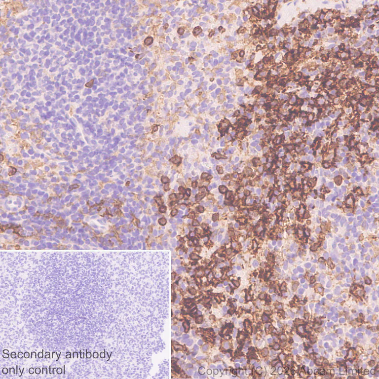 Immunohistochemistry (Formalin/PFA-fixed paraffin-embedded sections) - Anti-FcRgamma antibody [EPR30963-69] (AB325712)