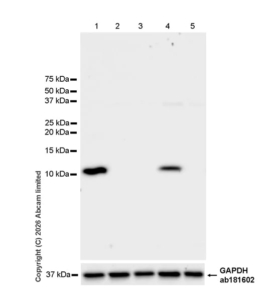 Western blot - Anti-FcRgamma antibody [EPR30963-69] (AB325712)