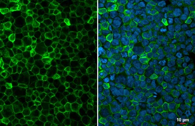 Immunocytochemistry/ Immunofluorescence - Anti-FcRgamma antibody [HL1418] - BSA and Azide free (AB313849)