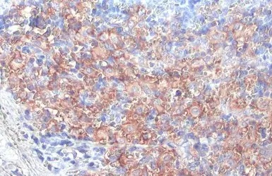 Immunohistochemistry (Formalin/PFA-fixed paraffin-embedded sections) - Anti-FcRgamma antibody [HL1418] - BSA and Azide free (AB313849), expandable thumbnail