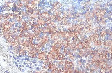 Immunohistochemistry (Formalin/PFA-fixed paraffin-embedded sections) - Anti-FcRgamma antibody [HL1418] - BSA and Azide free (AB313849)