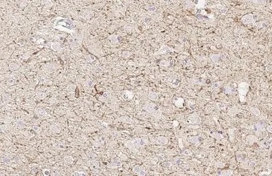 Immunohistochemistry (Formalin/PFA-fixed paraffin-embedded sections) - Anti-FcRgamma antibody [HL1418] - BSA and Azide free (AB313849), expandable thumbnail