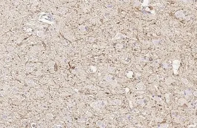 Immunohistochemistry (Formalin/PFA-fixed paraffin-embedded sections) - Anti-FcRgamma antibody [HL1418] - BSA and Azide free (AB313849)